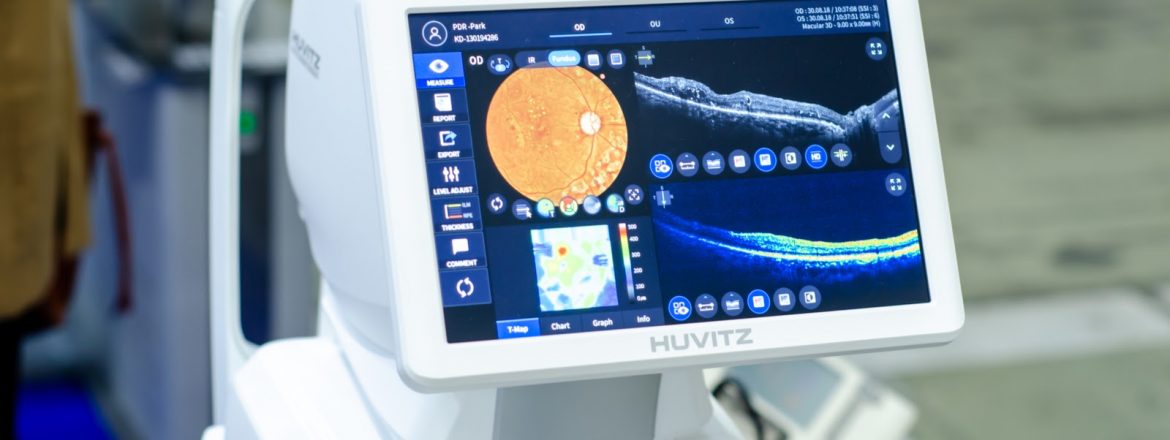 Optik Koherens Tomografi (OCT)